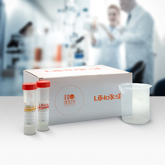 Analisi sulle urine del mattino
