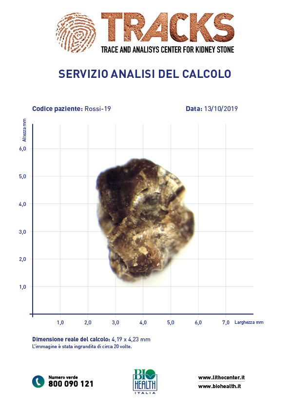 Analisi del calcolo